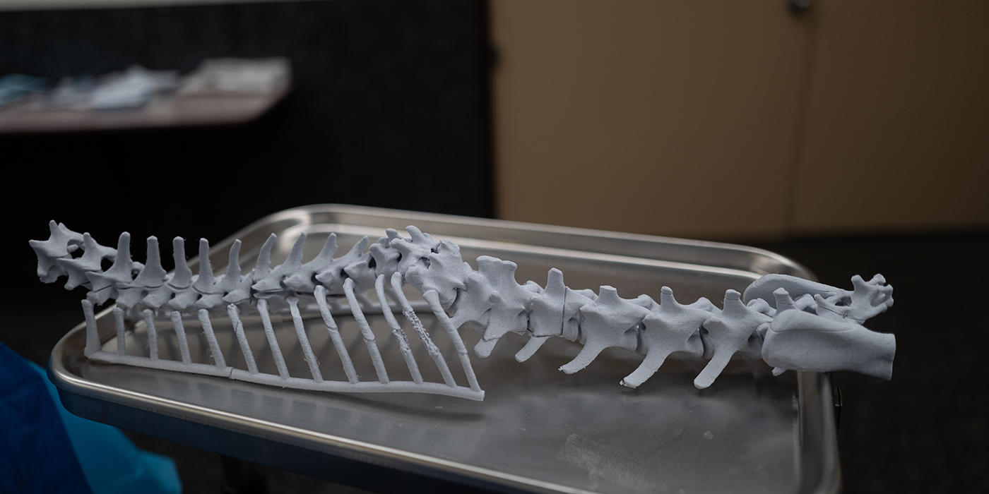 The 3D model of Freya's spine, placed on a metal table in the operating room.