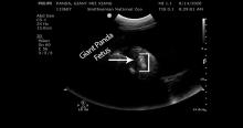 a black and white ultrasound image with arrow indicating the placement of a giant panda fetus in-utero